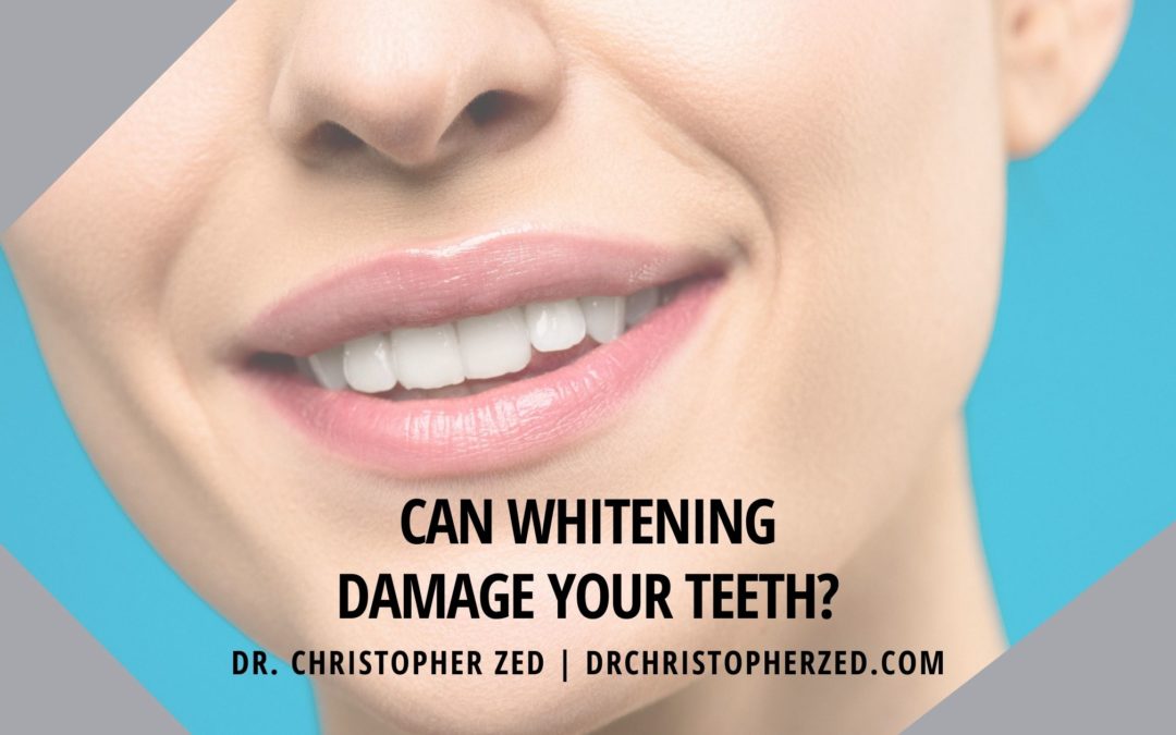 Can Whitening Damage Your Teeth?