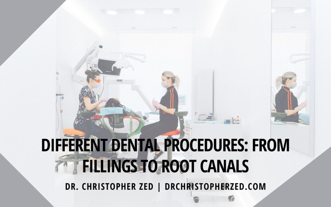 Different Dental Procedures: From Fillings to Root Canals
