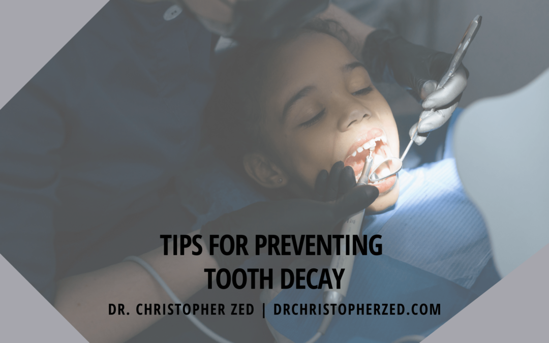 Tips for Preventing Tooth Decay