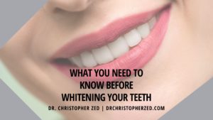 What You Need To Know Before Whitening Your Teeth