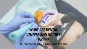 What Are Dental Veneers And Do They Work